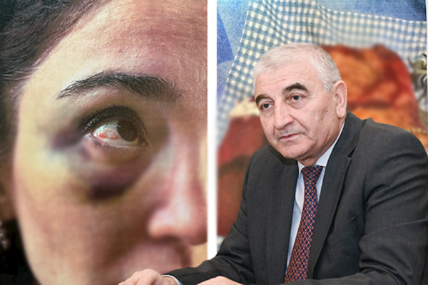 Məzahir Pənahovun oğlunun həyat yoldaşına qarşı zorakılıq etdiyi iddia olunur – Fotolar