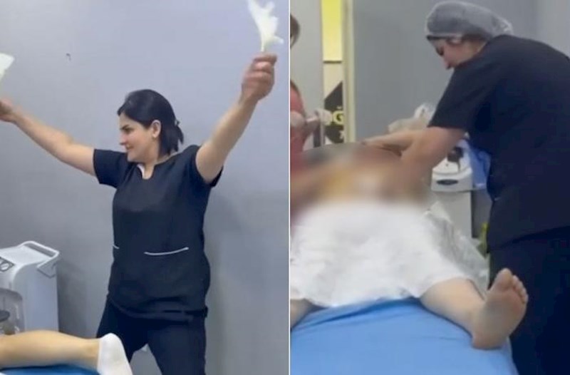 Prokurorluq estetik əməliyyat proseduru ilə bağlı yayılan görüntünü araşdırır